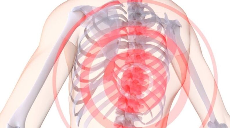 Osteochondrosis of the spine